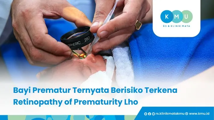 Orang Tua Wajib Tahu! Bayi Prematur Ternyata Berisiko Terkena Retinopathy of Prematurity Lho
