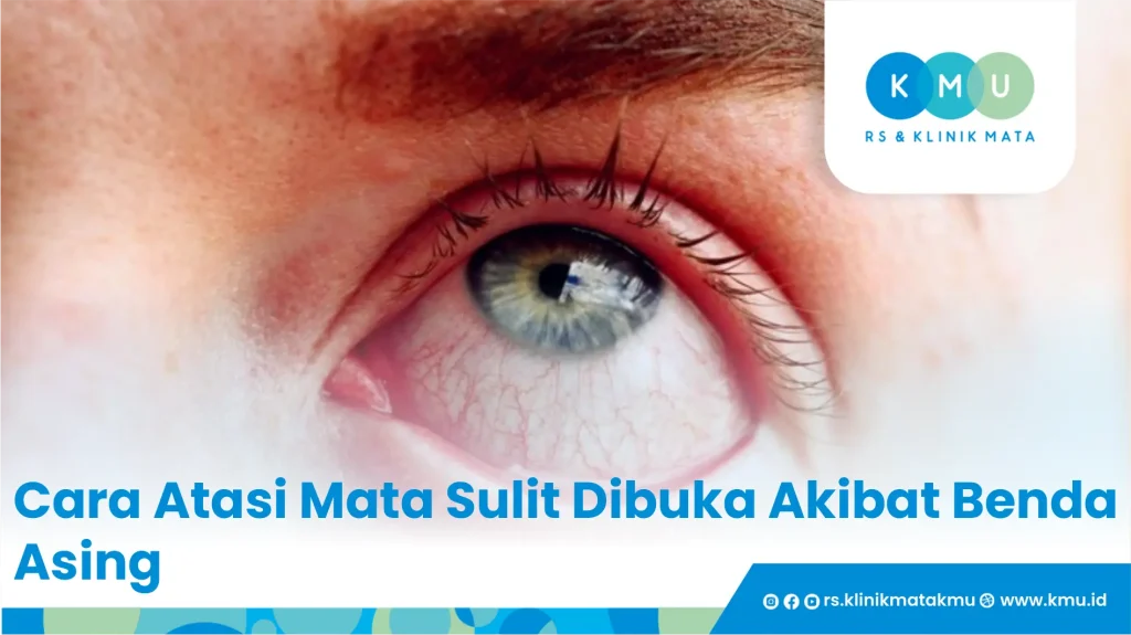 Mata Sulit Dibuka