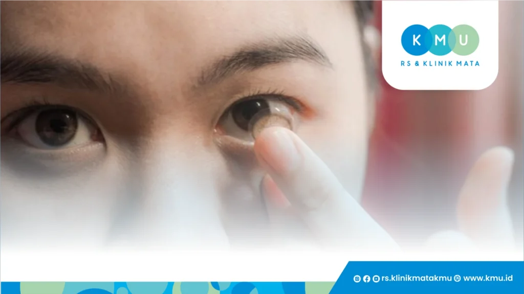 Bolehkah Softlens Baru Langsung Dipakai?