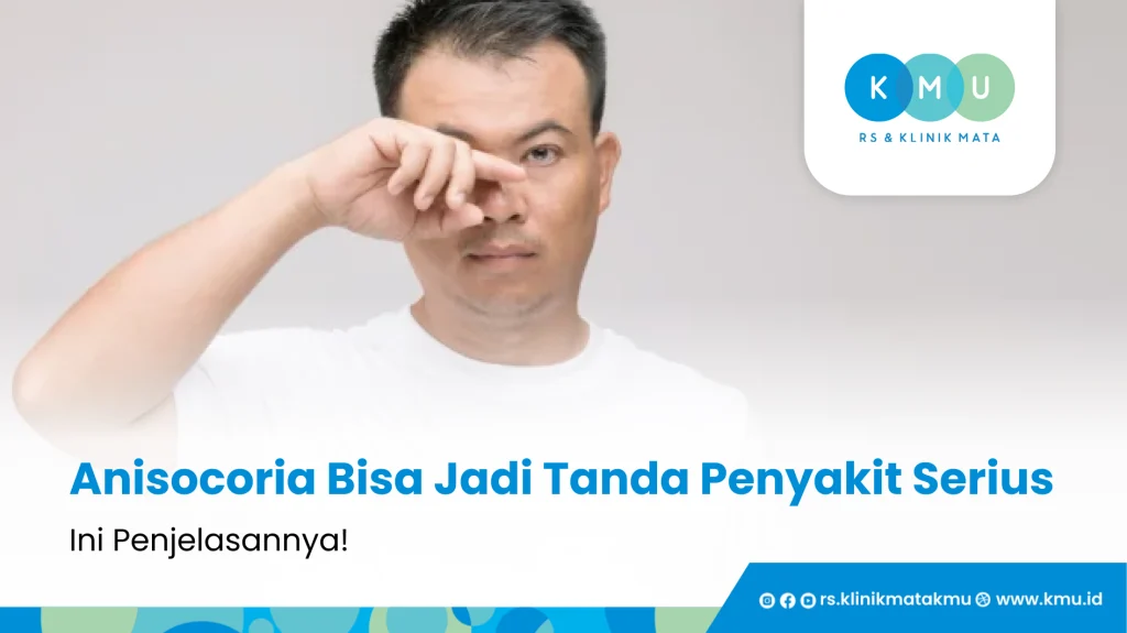 Anisocoria Bisa Jadi Tanda Penyakit Serius, Ini Penjelasannya!
