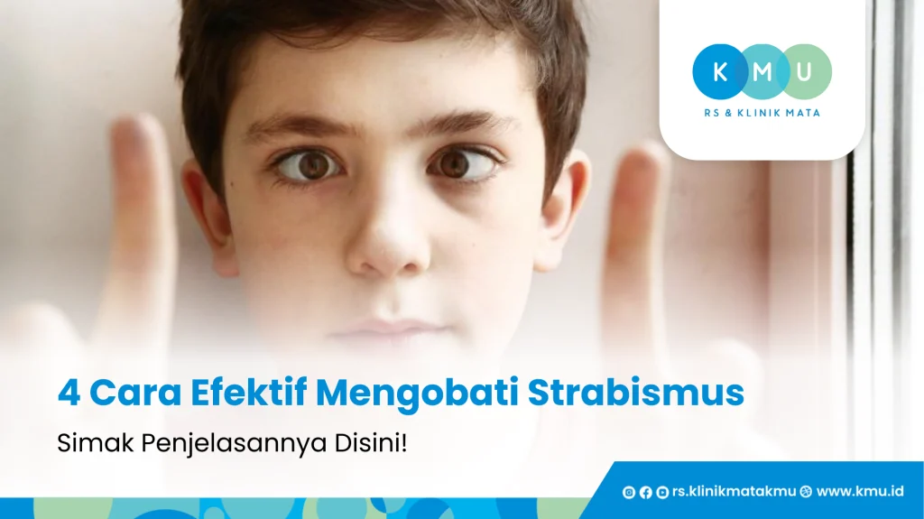 Strabismus - 4 Cara Efektif Mengobati Mata Juling Yang Perlu Kamu Ketahui!