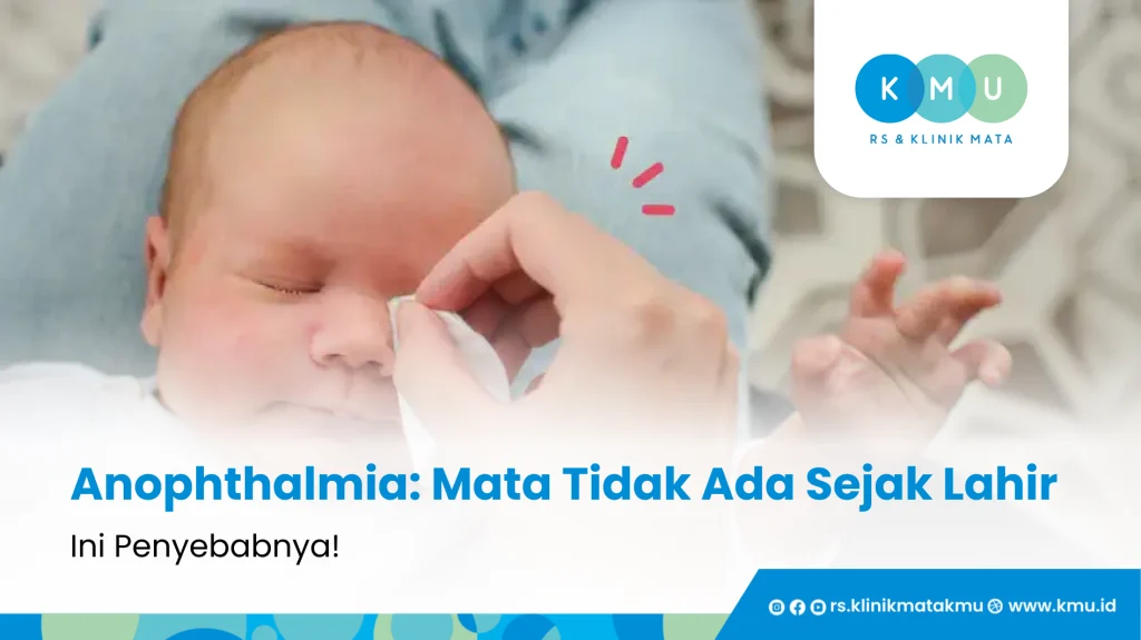 Anophthalmia - Mata Tidak Ada Sejak Lahir, Ini Penyebabnya!