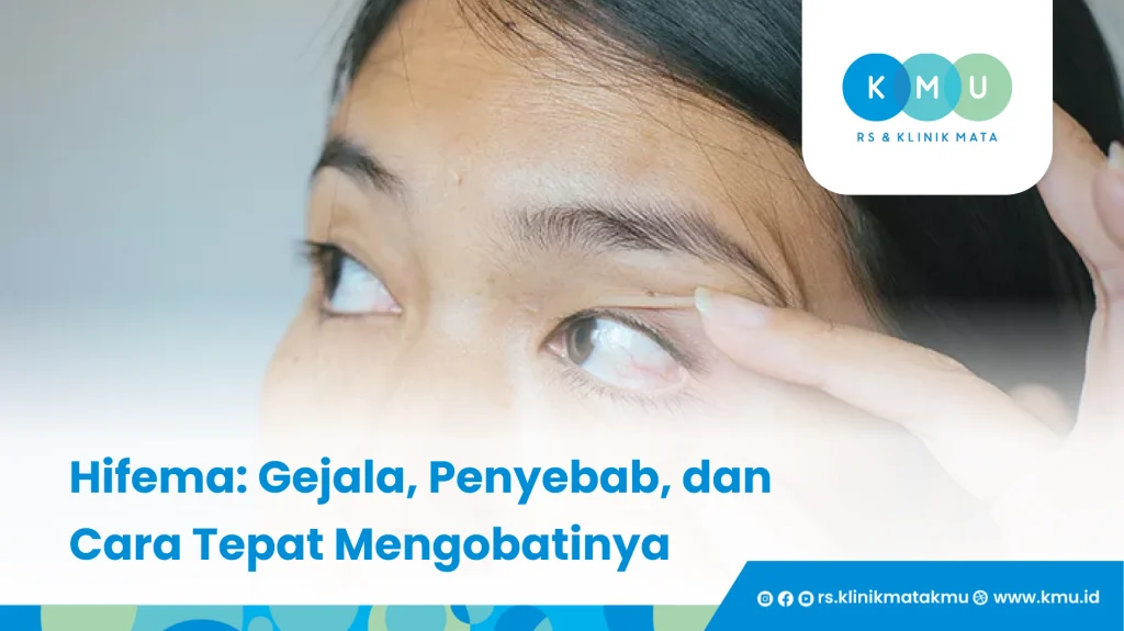 Hifema - Gejala, Penyebab, dan Cara Tepat Mengobatinya