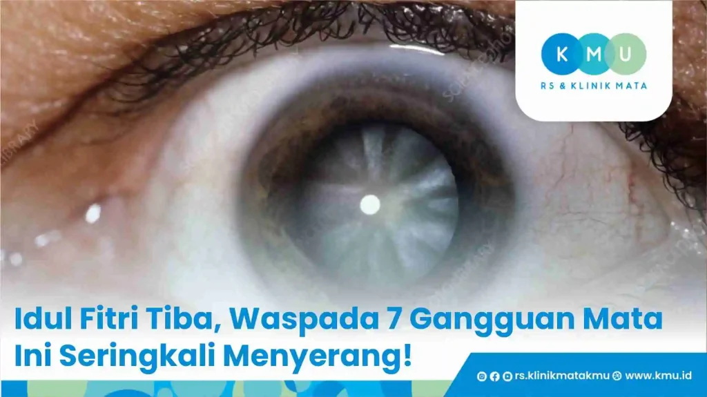 Idul Fitri Tiba, Waspada 7 Gangguan Mata Ini Seringkali Menyerang!