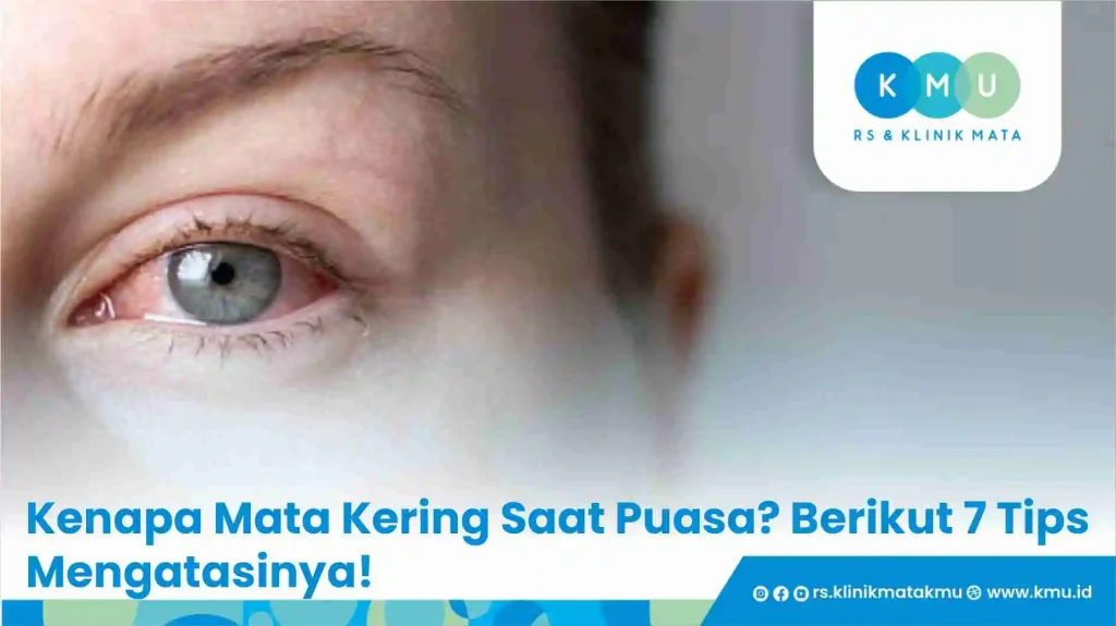 Kenapa Mata Kering Saat Puasa? Berikut 7 Tips Mengatasinya!
