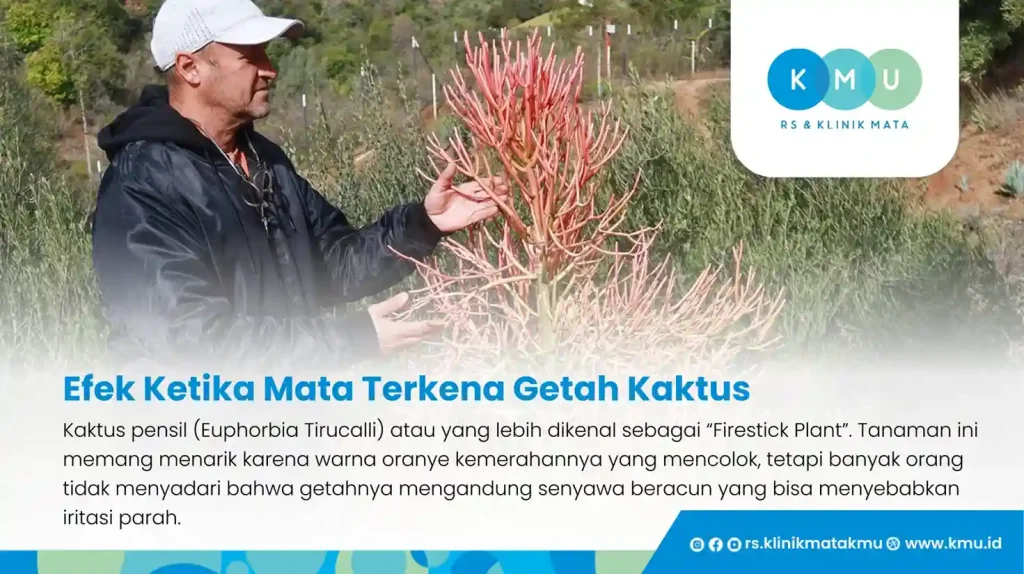 Mata Terkena Getah Kaktus? Ini 5 Langkah Cepat untuk Menanganinya!