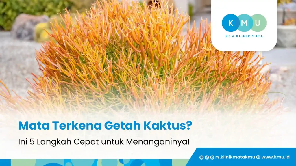 Mata Terkena Getah Kaktus? Ini 5 Langkah Cepat untuk Menanganinya!