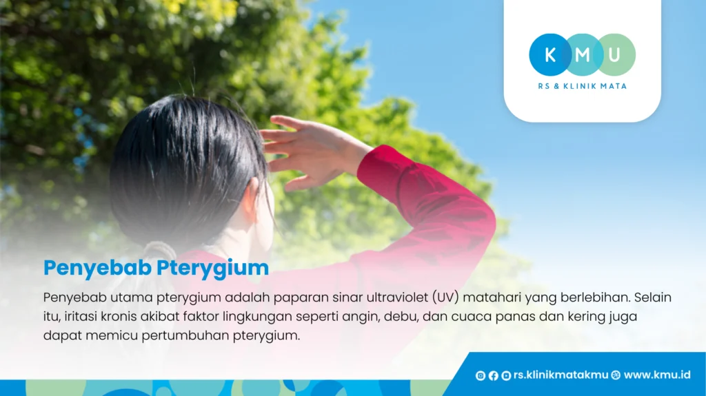 Penyebab Pterygium - Pengobatan Pterygium