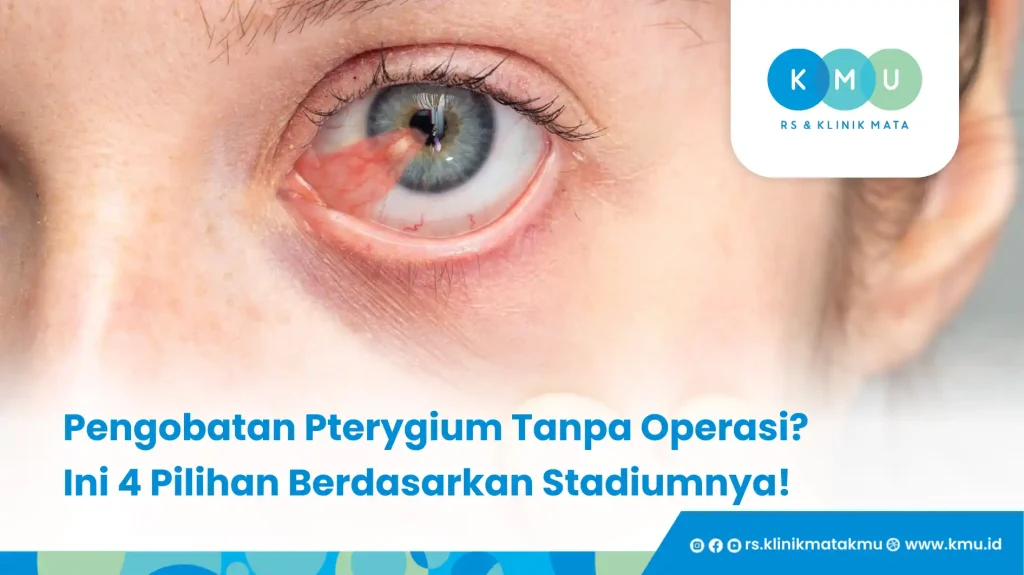 Pengobatan Pterygium Tanpa Operasi? Ini 4 Pilihan Berdasarkan Stadiumnya!