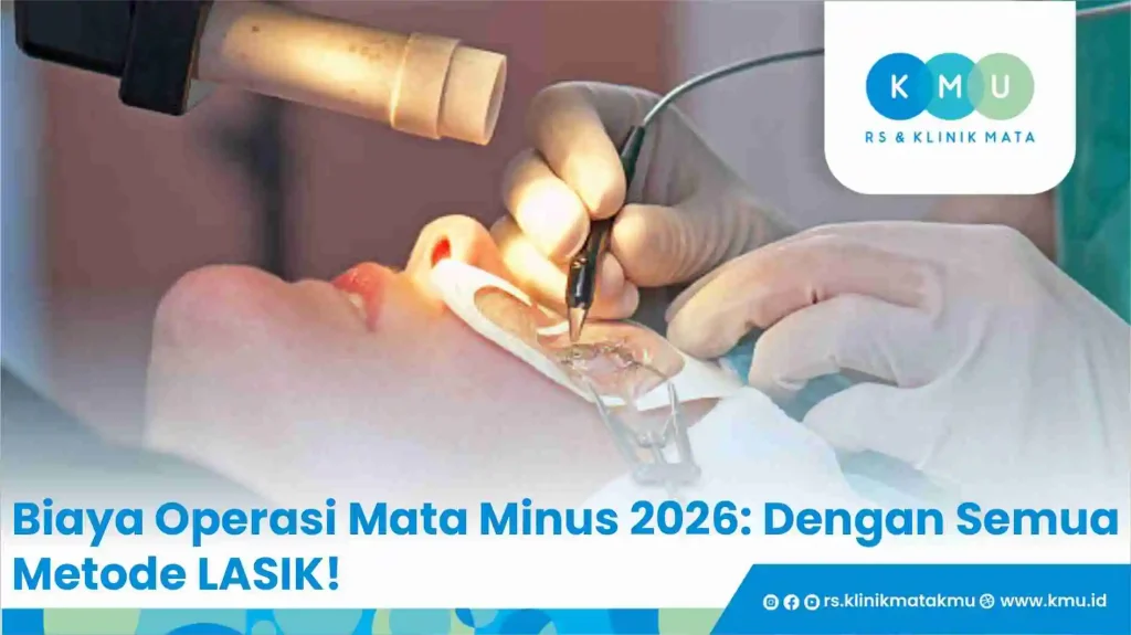 Biaya Operasi Mata Minus 2026: Dengan Semua Metode LASIK!
