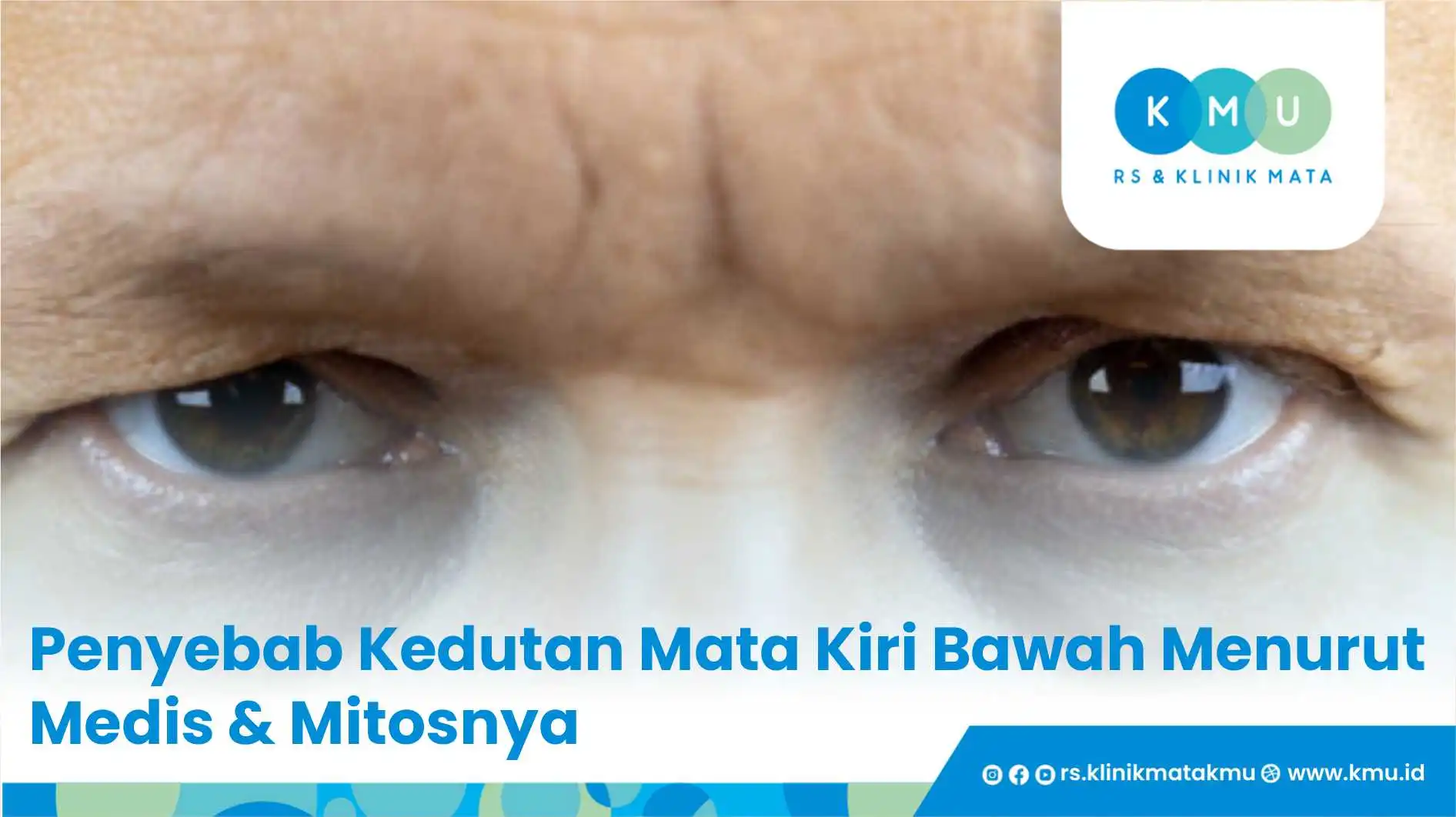 Penyebab Kedutan Mata Kiri Bawah Menurut Medis & Mitosnya!