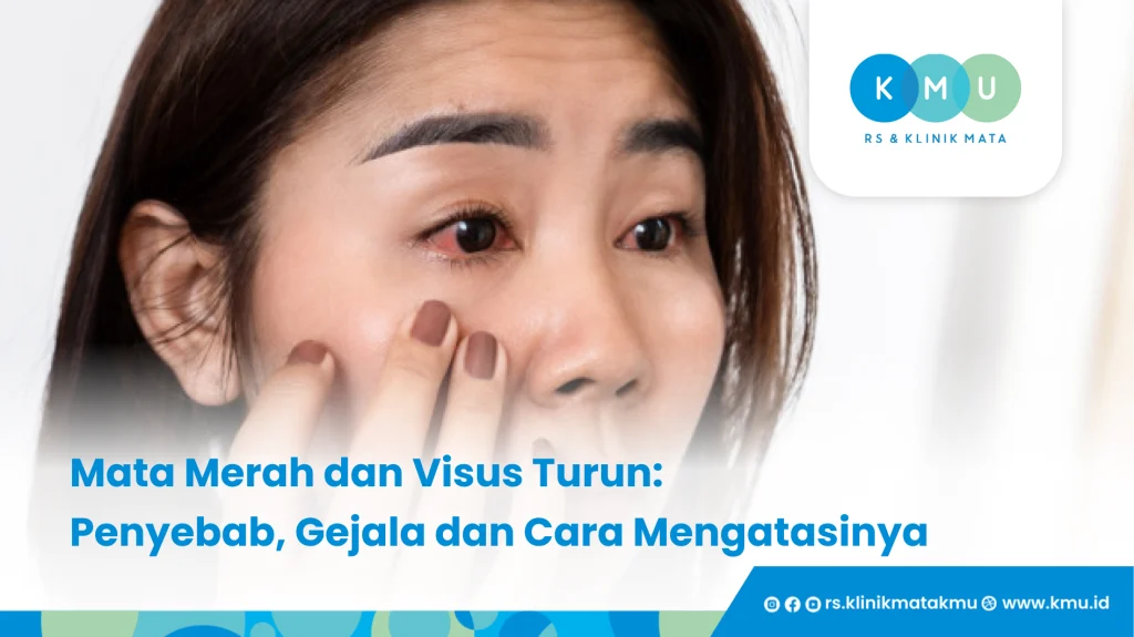 Mata Merah dan Visus Turun, Penyebab, Gejala dan Cara Mengatasinya