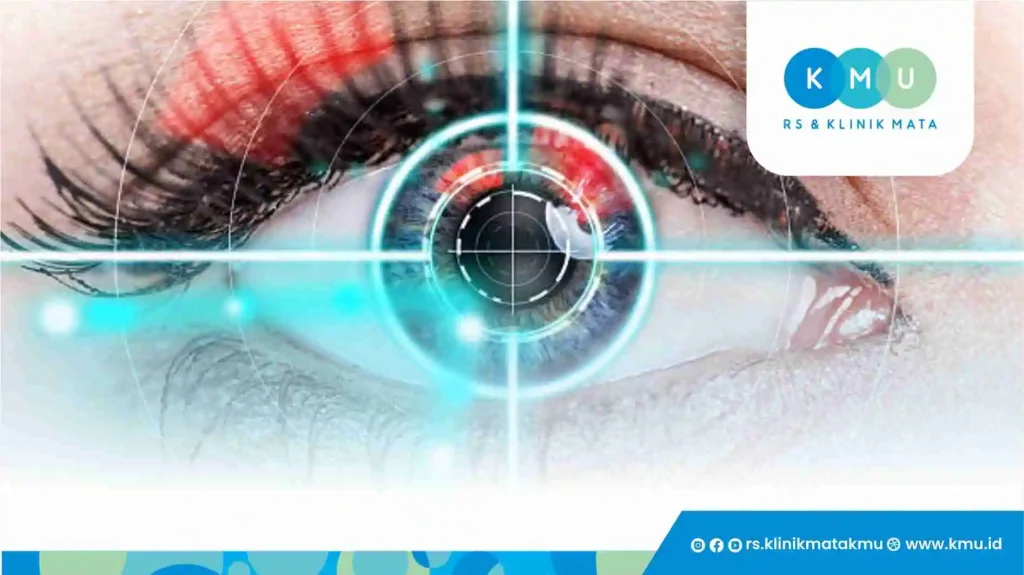Apa Itu Operasi Retina Mata?