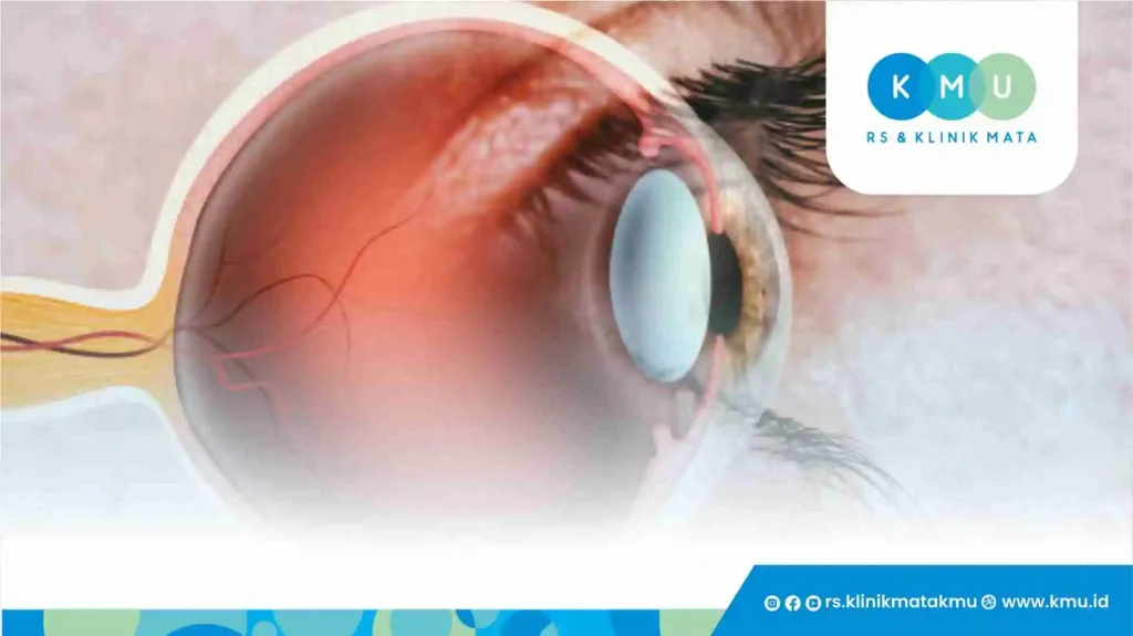 Mengapa Retina Mata Penting?