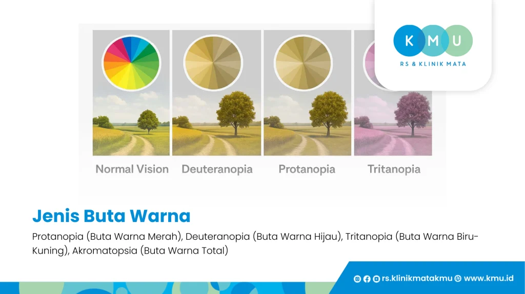 Jenis Buta Warna