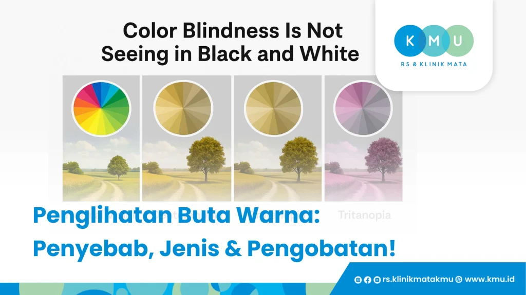 Penglihatan Buta Warna, Penyebab, Jenis dan Pengobatan!