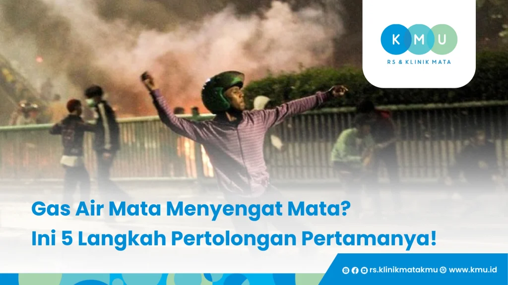 Gas Air Mata Menyengat Mata, Ini 5 Langkah Pertolongan Pertamanya!