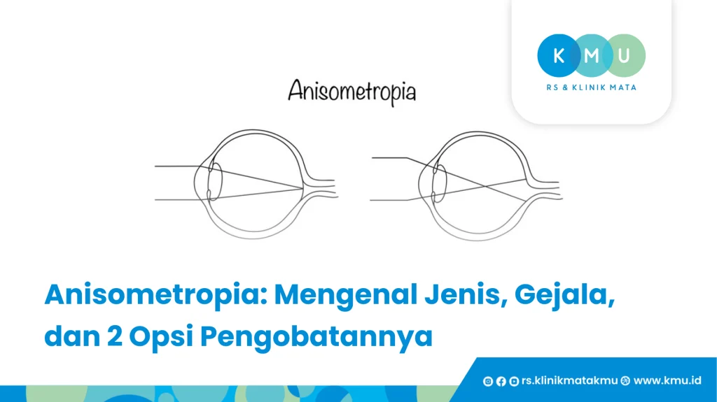 Anisometropia- Mengenal Jenis, Gejala, dan 2 Opsi Pengobatannya