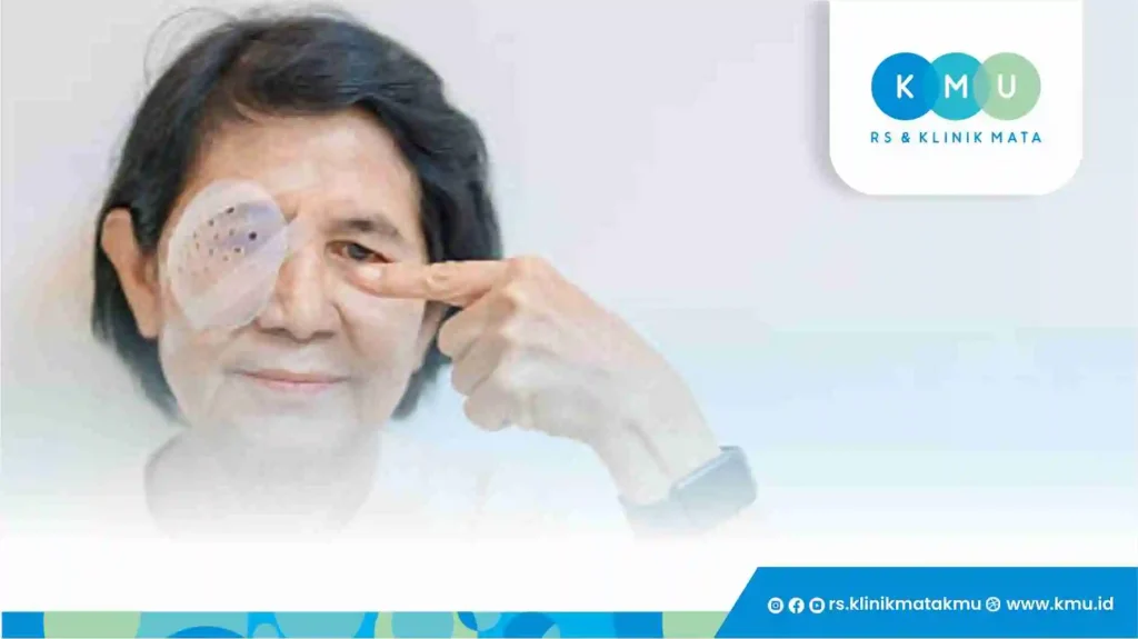 Penyebab Katarak yang Sering Tidak Disadari