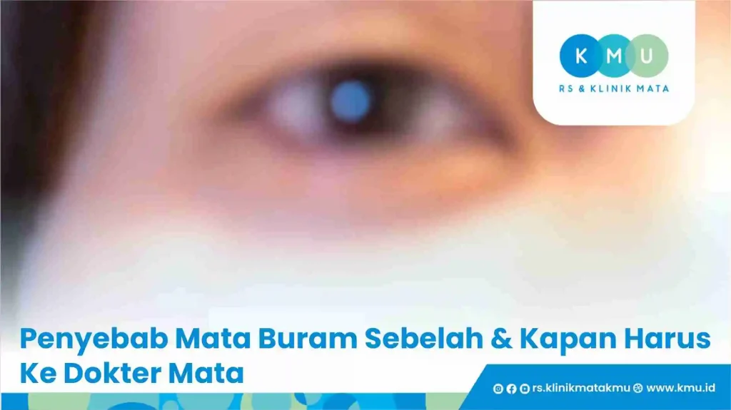 Penyebab Mata Buram Sebelah & Kapan Harus Ke Dokter Mata