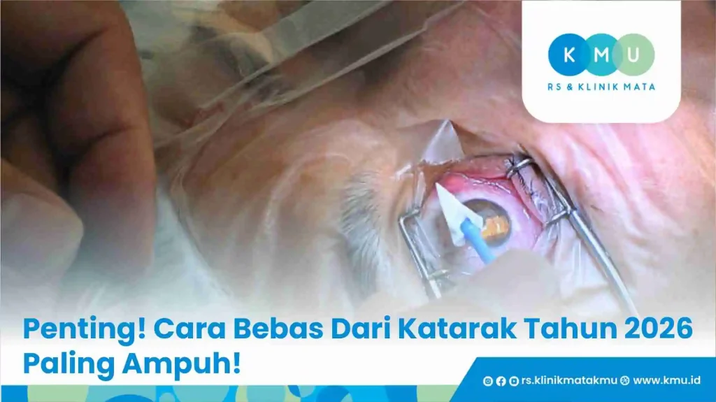 Penting! Cara Bebas Dari Katarak Tahun 2026 Paling Ampuh!