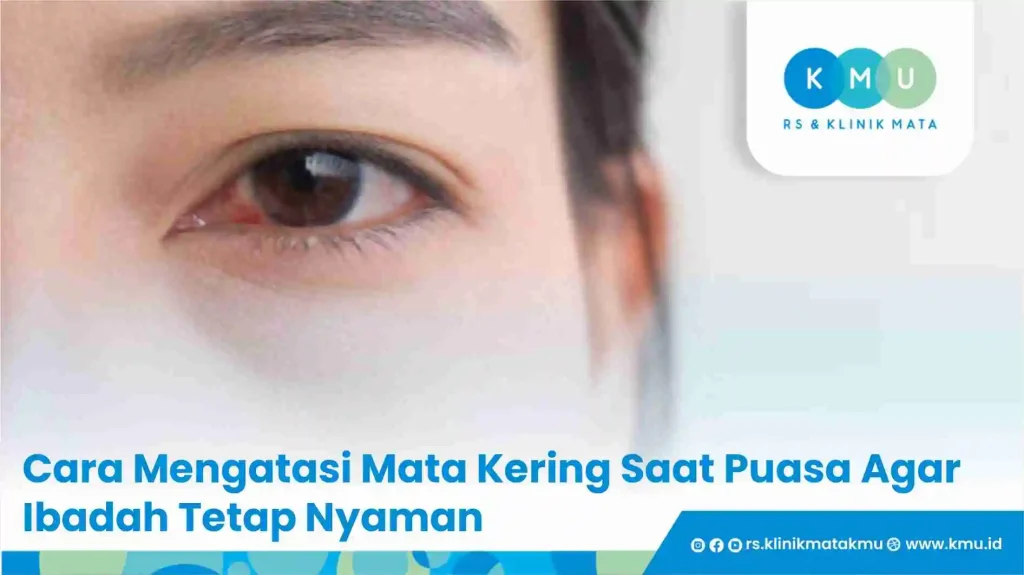Cara Mengatasi Mata Kering Saat Puasa Agar Ibadah Tetap Nyaman
