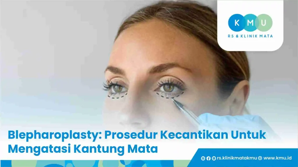 Blepharoplasty: Prosedur Kecantikan Untuk Mengatasi Kantung Mata
