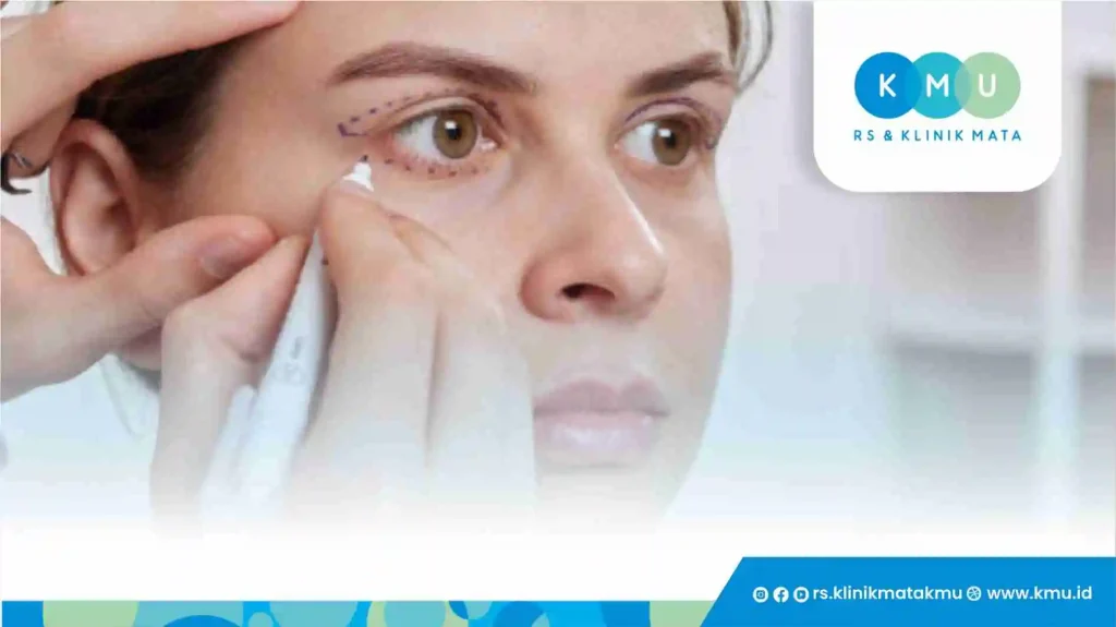 Siapa yang Cocok Melakukan Blepharoplasty?