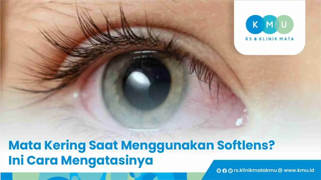 Mata Kering Saat Menggunakan Softlens? Ini Cara Mengatasinya