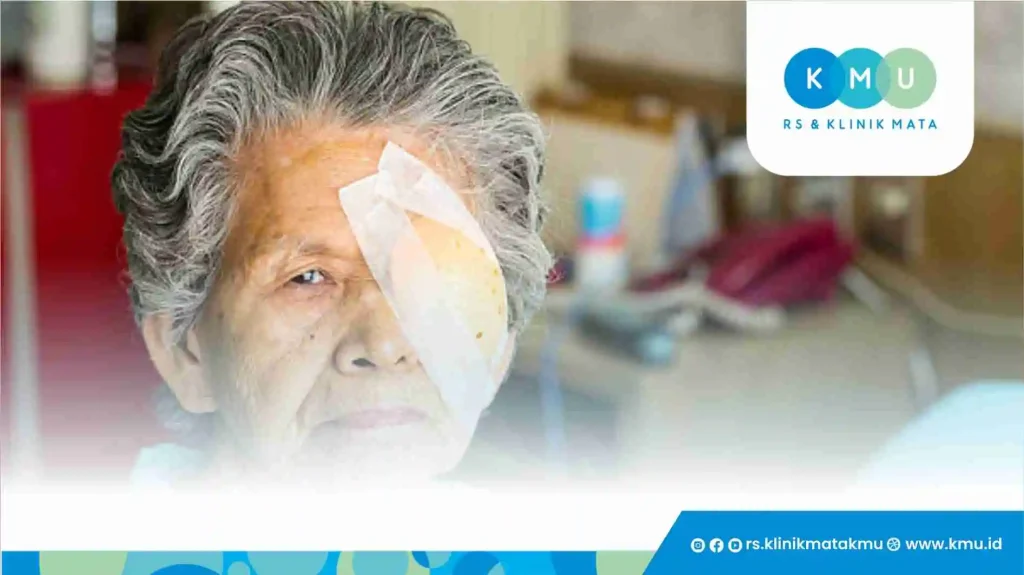 Berapa Lama Pemulihan Pasca Operasi Katarak?