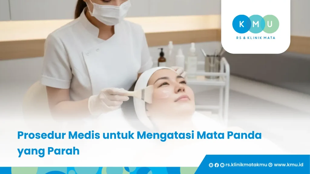 Prosedur Medis untuk Mengatasi Mata Panda yang Parah - Cara Mengatasi Mata Panda
