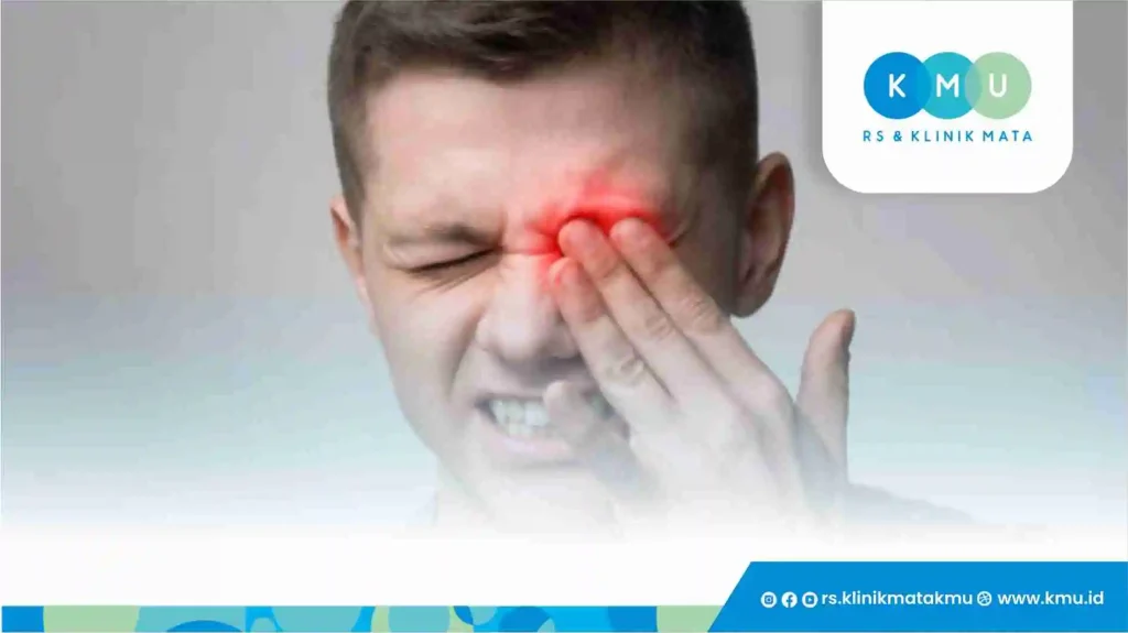 Cara Mengatasi Mata Gatal Secara Efektif