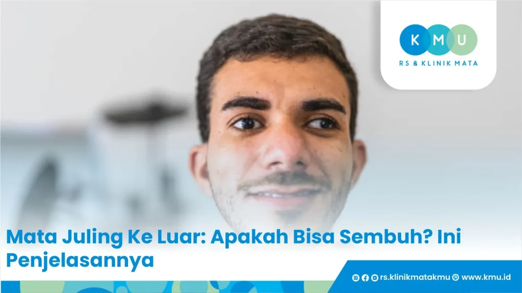 Mata Juling Ke Luar: Apakah Bisa Sembuh? Ini Penjelasannya