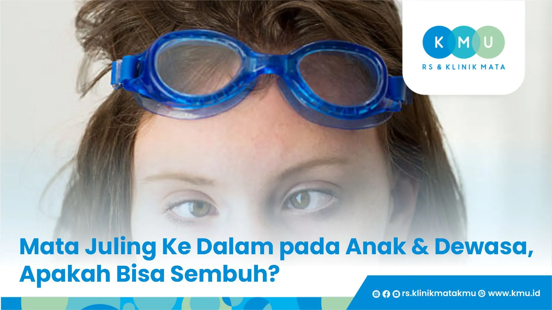 Mata Juling Ke Dalam pada Anak & Dewasa, Apakah Bisa Sembuh?