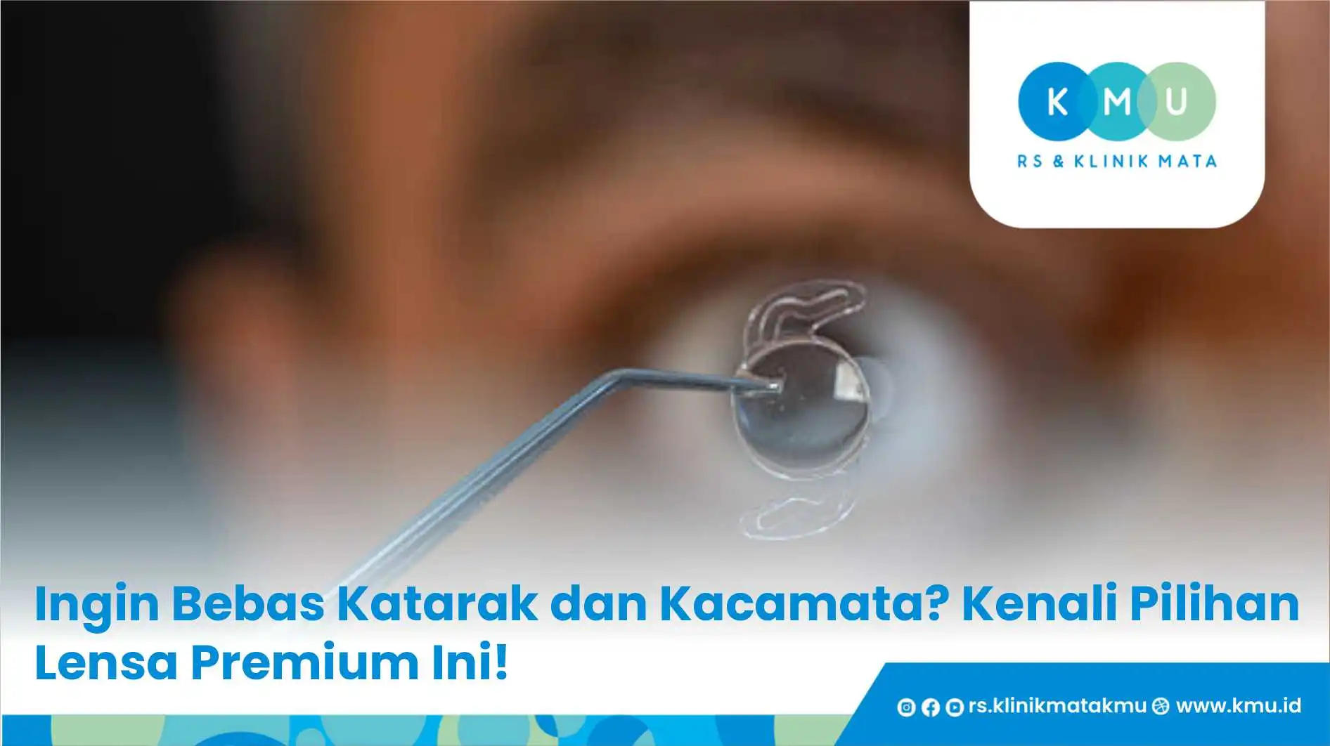 Ingin Bebas Katarak dan Kacamata? Kenali Pilihan Lensa Premium