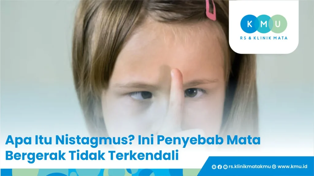 Apa Itu Nistagmus? Ini Penyebab Mata Bergerak Tidak Terkendali
