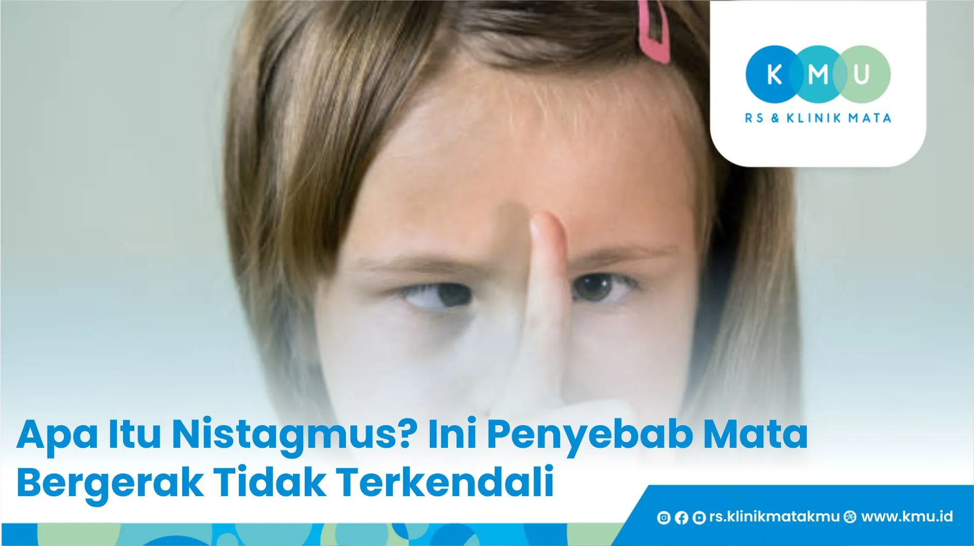 Apa Itu Nistagmus? Ini Penyebab Mata Bergerak Tidak Terkendali