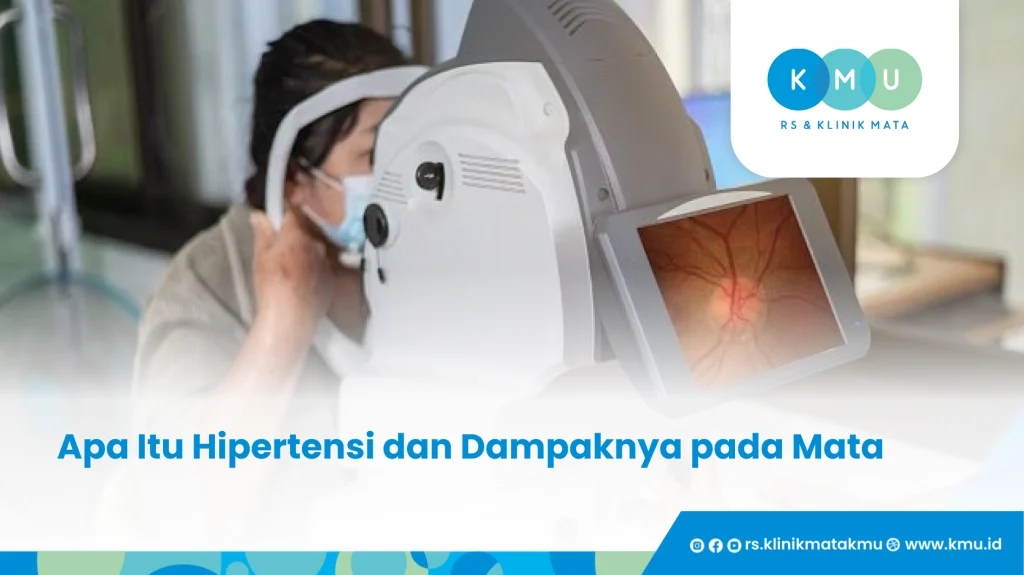 Apa Itu Hipertensi dan Dampaknya pada Mata - Retinopati Hipertensi