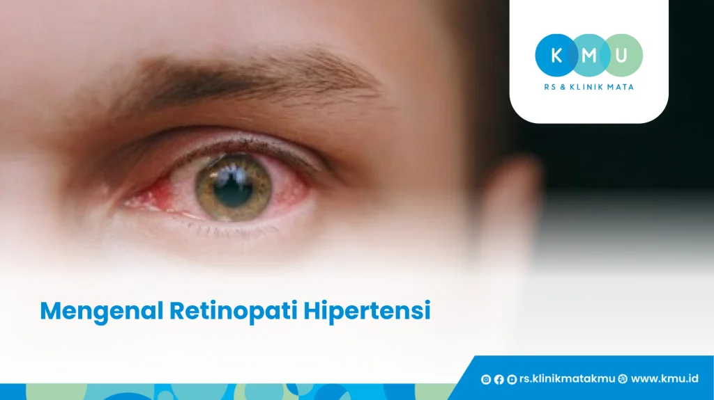 Mengenal Retinopati Hipertensi