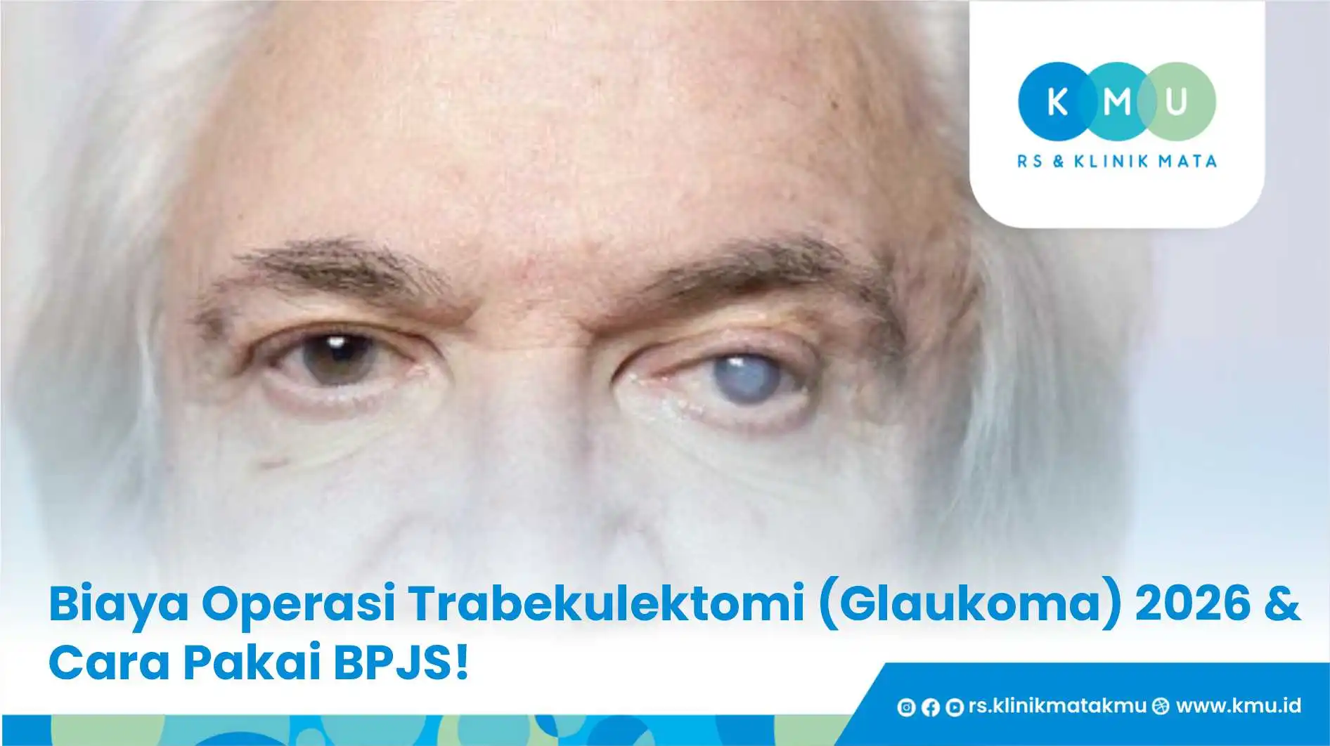 Biaya Operasi Trabekulektomi (Glaukoma) 2026 & Cara Pakai BPJS!