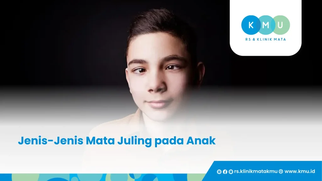 Jenis-Jenis Mata Juling pada Anak
