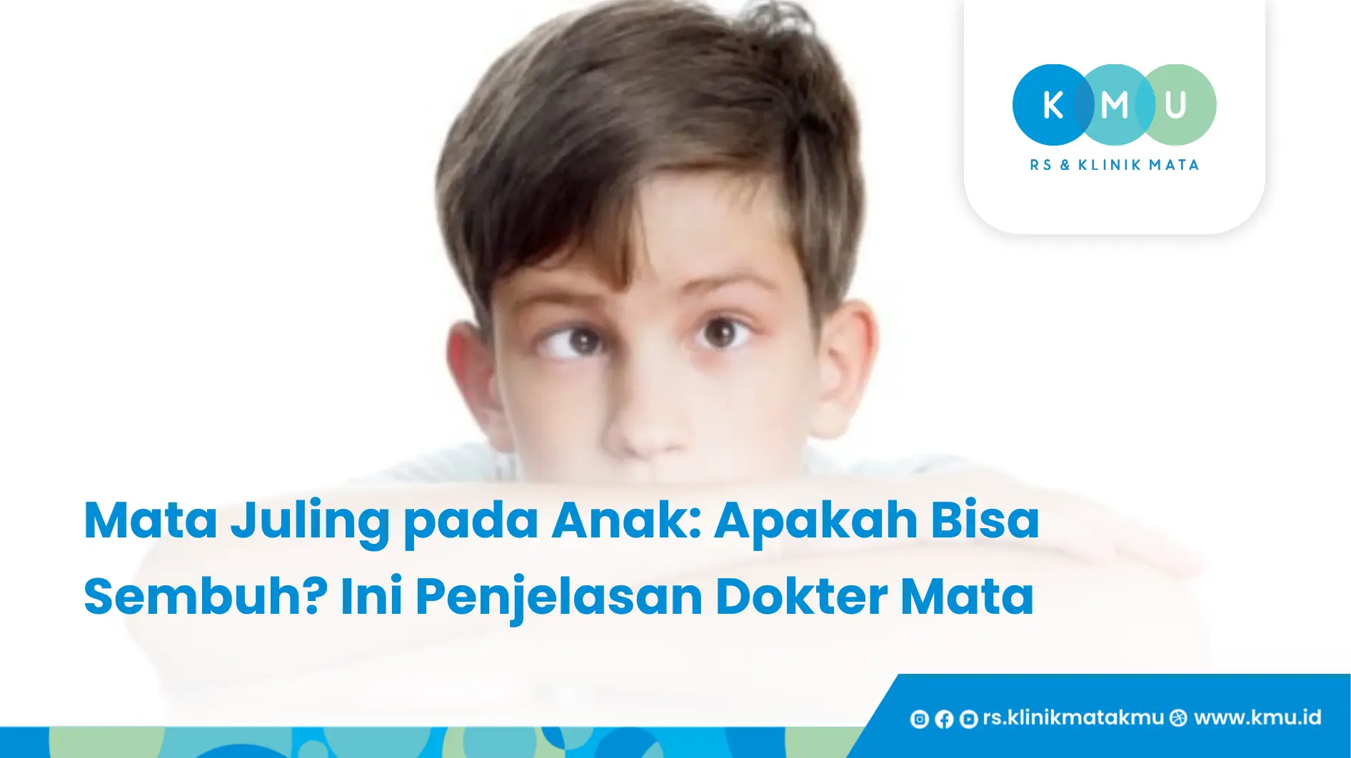 Mata Juling pada Anak_ Apakah Bisa Sembuh_ Ini Penjelasan Dokter Mata