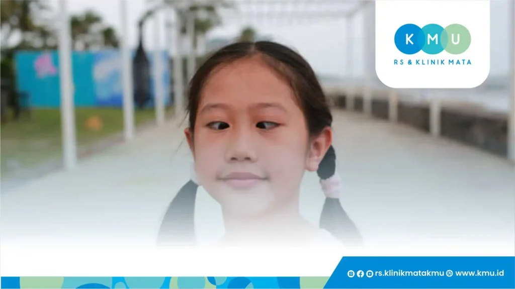 Penyebab Mata Juling pada AnakÂ