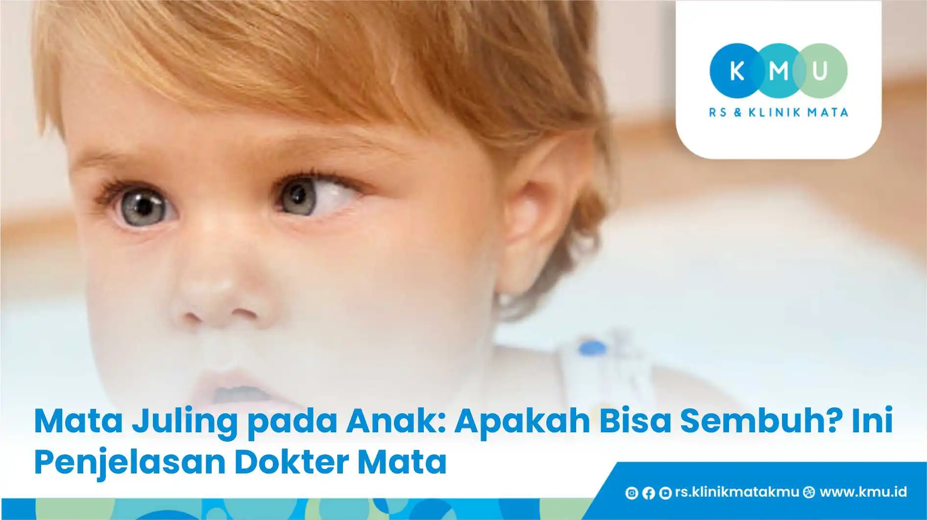 Mata Juling pada Anak: Apakah Bisa Sembuh? Ini Penjelasan Dokter Mata