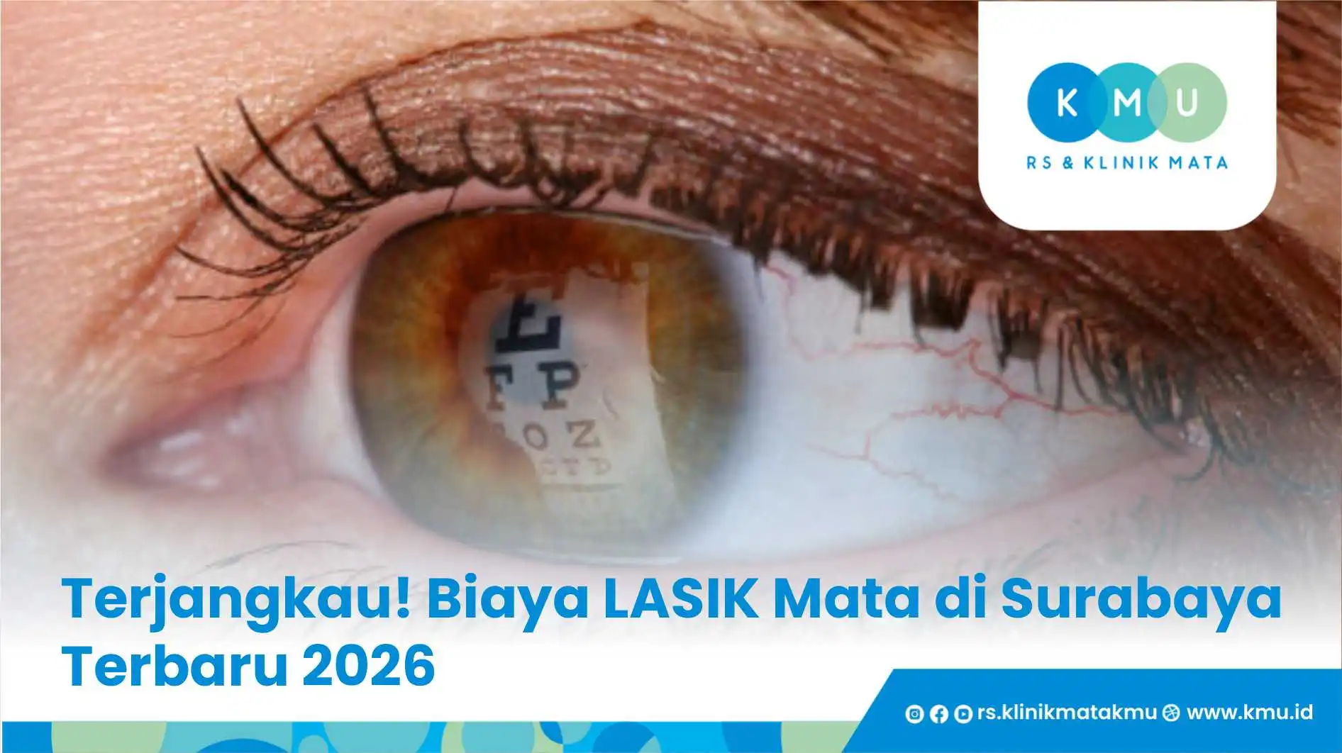 Terjangkau! Biaya LASIK Mata di Surabaya Terbaru 2026
