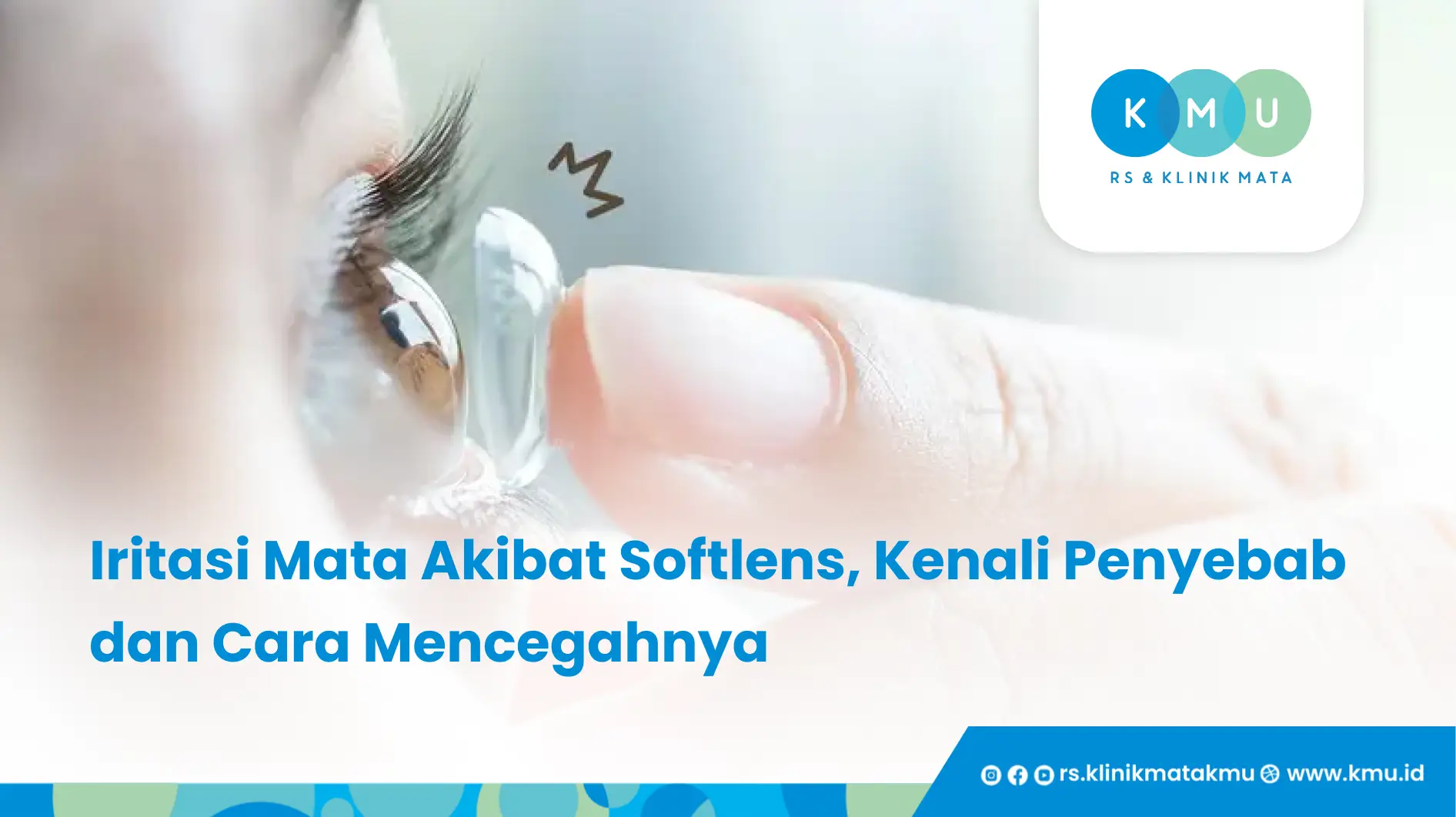 Iritasi Mata Akibat Softlens, Kenali Penyebab dan Cara Mencegahnya