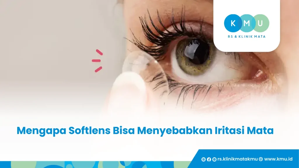 Mengapa Softlens Bisa Menyebabkan Iritasi Mata - Iritasi Mata Akibat Softlens