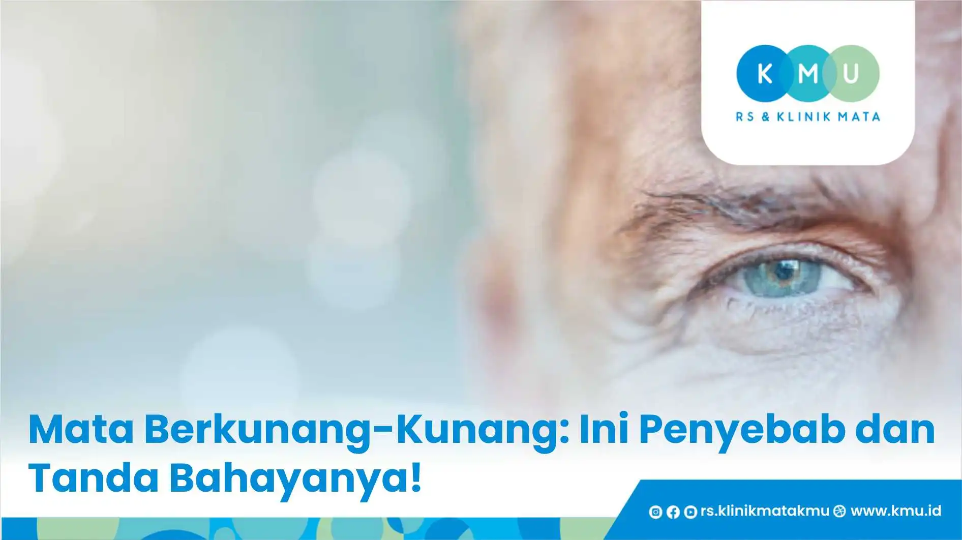 Mata Berkunang-Kunang: Ini Penyebab dan Tanda Bahayanya!