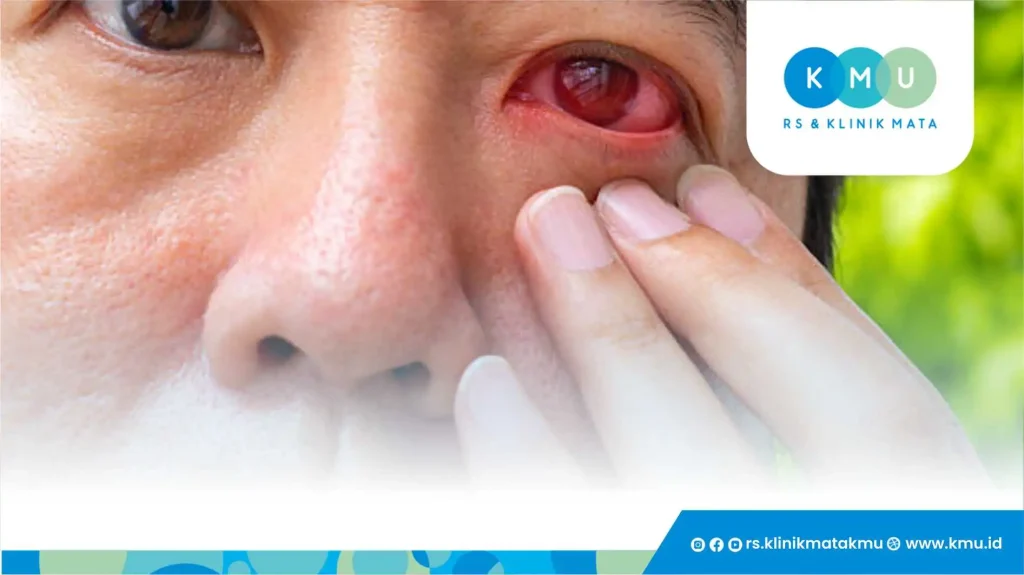 Mengapa Glaukoma Bisa Menyebabkan Mual dan Muntah?