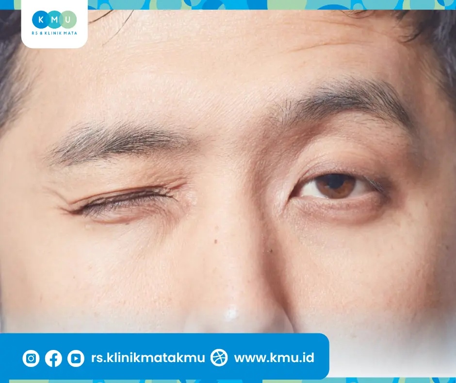 mitos mata berkedut